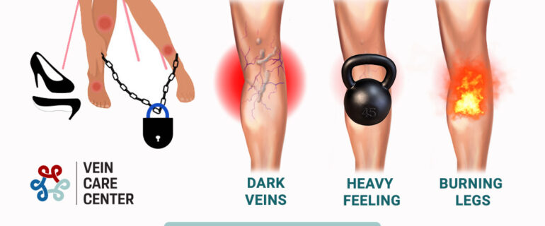 Advantages of Services in Vein Care Center (Paramus)