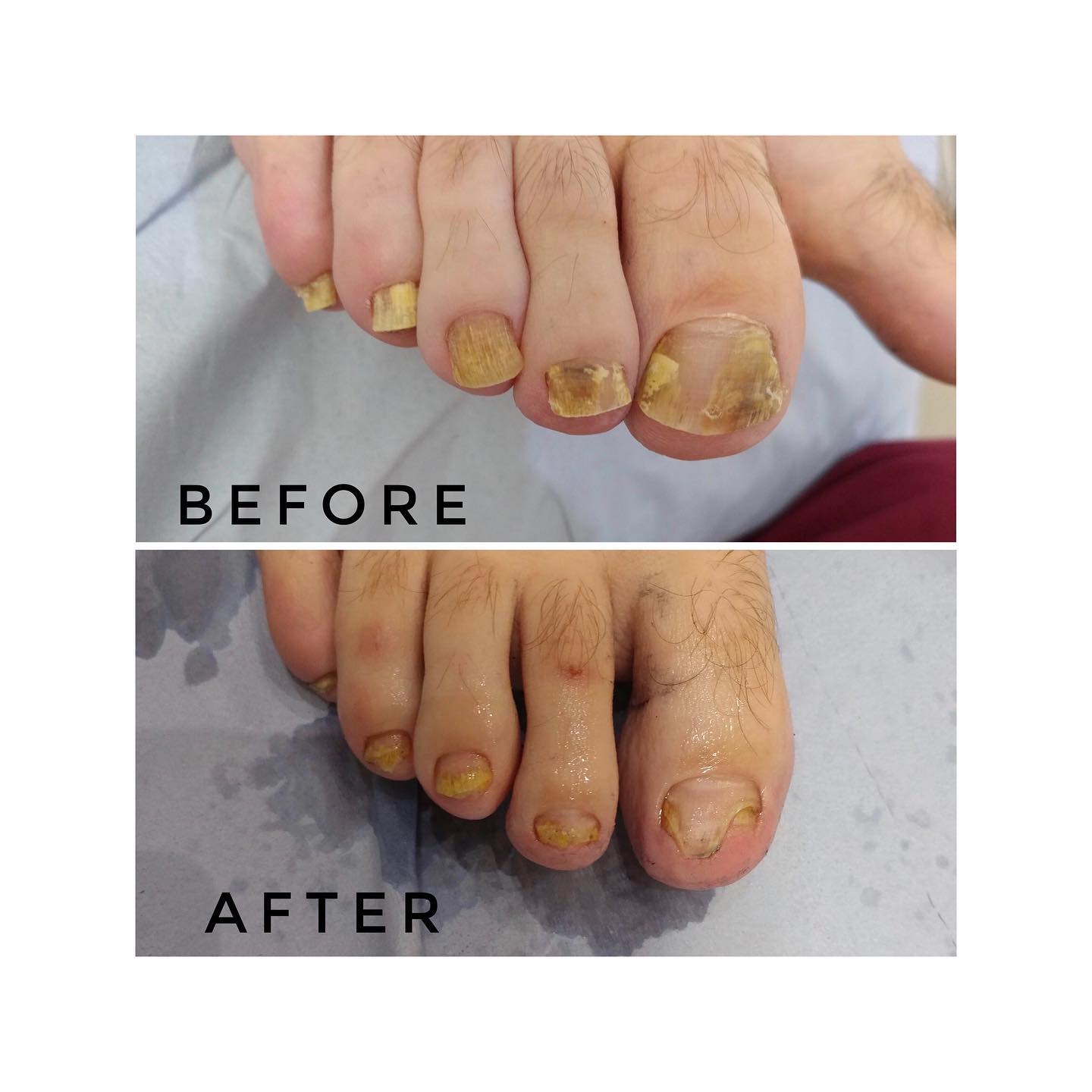 Harley Medical Foot and Nail Laser Clinic